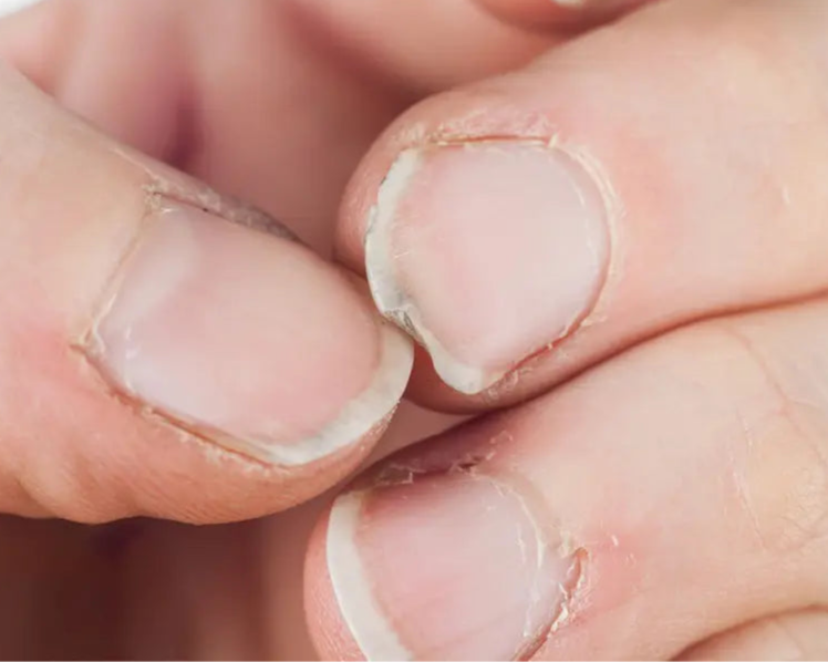 Nagelversterkende groeiserum